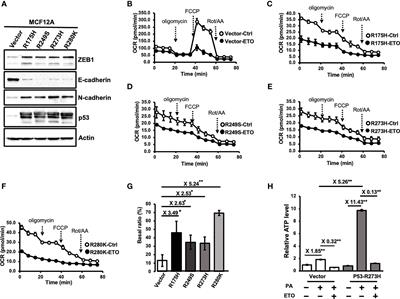 Mutant p53-microRNA-200c-ZEB2-Axis-Induced CPT1C Elevation Contributes to Metabolic Reprogramming and Tumor Progression in Basal-Like Breast Cancers